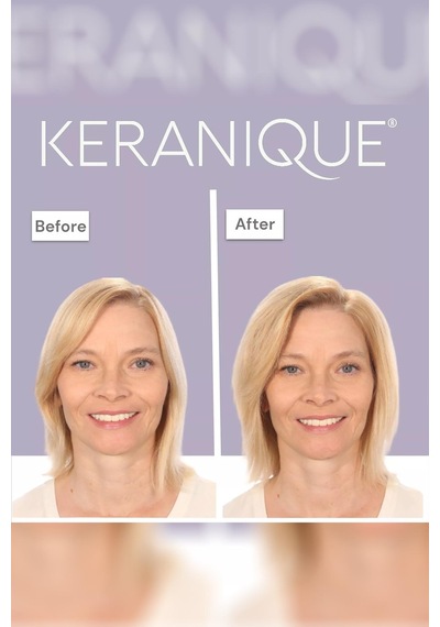 Keranique Volumizing Follicle Strengthening Şampuan 355ml