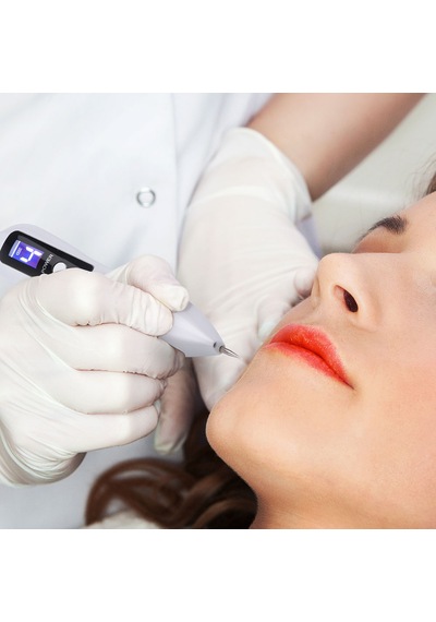 Profesyonel 9 Kademe Dijital Laser Plazma Plasma Pen Kalem Beyaz