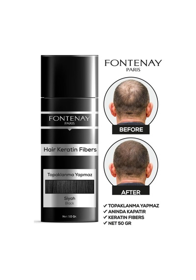 Fontenay Topik Keratin Fıbers Siyah
