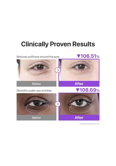 No.9 Nad+ Collagen Gel Eye Patches- Peptid, Kafein Ve Niasinamidli Göz Altı Jel Pedleri 5 Çift