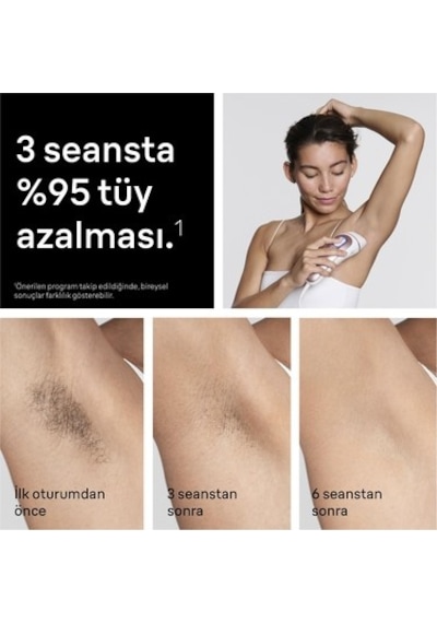Kablolu Ipl Cihazı, Etkili Tüy Alma İçin Cilt Temas Sensörü İle