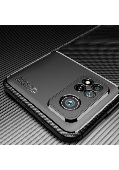 Smcase Xiaomi Redmi K30s Kılıf Negro Karbon Dokulu Silikon