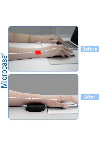 Microcase Ortopedik Mouse Bilek Destek - Kaydırmaz Taban Ergonomik Mouse Önü Bilek Destek Pedi - Al5373 Siyah