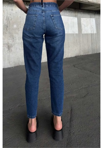 Kene Jeans Yüksek Bel Tam Kalıp Laci İşlemli Lazer Yırtık Mom Jeans Lacivert İşlemli
