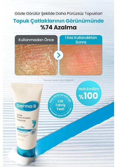 Kuru Ve Çatlamış Topuklar İçin, Peeling Etkili Nemlendirici Ayak Kremi Derma:b Urea Foot Cream