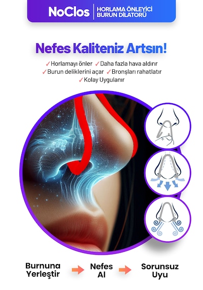 Noclos Nefes Açmayı Destekleyen Burun Dilatörü Kırmızı