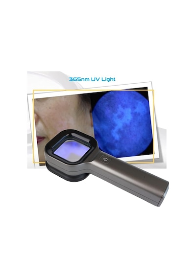 Wood Işığı Dermatolog Güzellik Merkezi Uv Cilt Analiz Cihazı