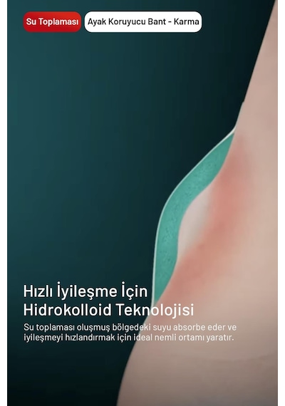 Compeed Acıyı Hızla Hafifleten Hidrokolloid Ayak Koruma Ve Yara Bandı Karma Set