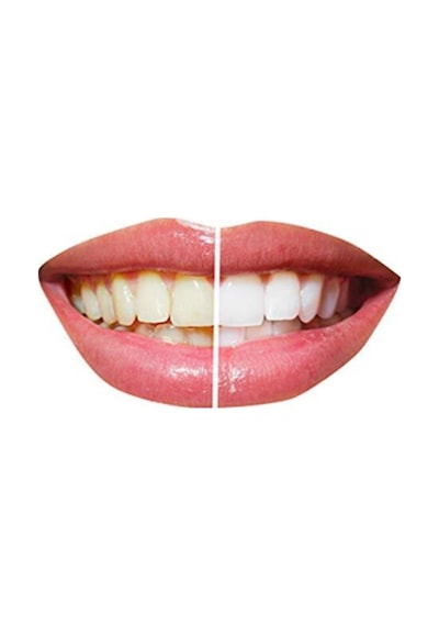 Oral-B Braun ile Uyumlu Yedek Başlık 8 Adet (2 Paket)