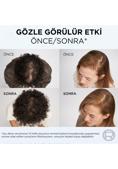 Lexroo Growth Booster Dökülme Karşıtı Saç Bakım Serumu 102ml