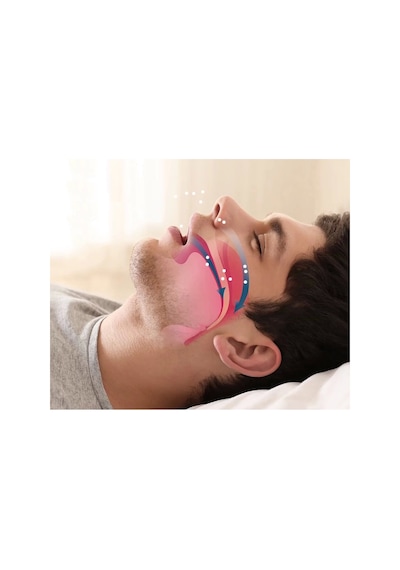 Rahat Uyku İçin Anti Snore Sleep Horlama Engelleyici Aparat Uyku Stoperi Lisinya