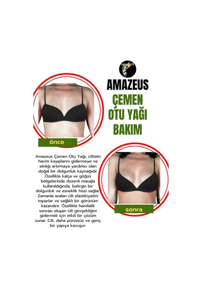 Amazeus Çemen Otu Yağı %100 Saf Ve Doğal Besleyici Etki 20 Ml / 0.7 Fl Oz