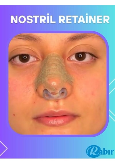 Rabır Nostril Retainer Burun Deliği Şekillendirici 8-8