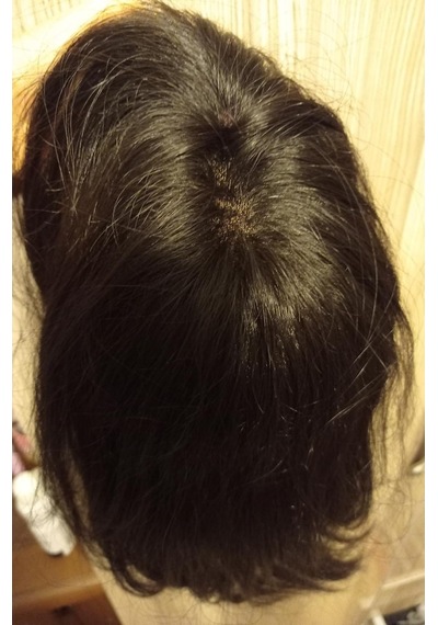Tığ İşi İnsan Saçı Tepelik.Türk Saçı.Hilly Lace Front Human Hair