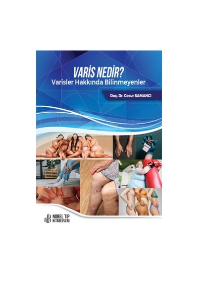 Varis Nedir Varisler Hakkında Bilinmeyenler