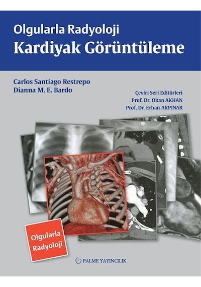 Olgularla Radyoloji Kardiyak Görüntüleme (Palme)