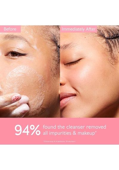 Lexroo Vinohydra Cleansing Gel 150 Ml