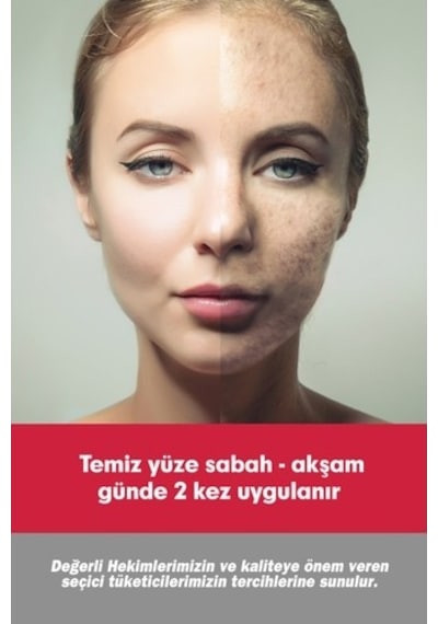 Tto Clinic Leke Kremi 75ml