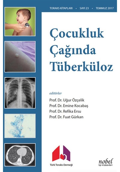 Çocukluk Çağında Tüberküloz- Nobel Tıp Kitabevleri