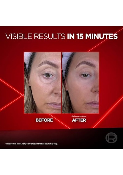 L'oreal Parıs Revitalift Lazer Eyebag Instant Eraser Göz Altı Torba Görünümüne Karşı Etkili Göz Kremi 15ml