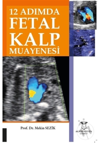 12 Adımda Fetal Kalp Muayenesi-Mekin Sezik