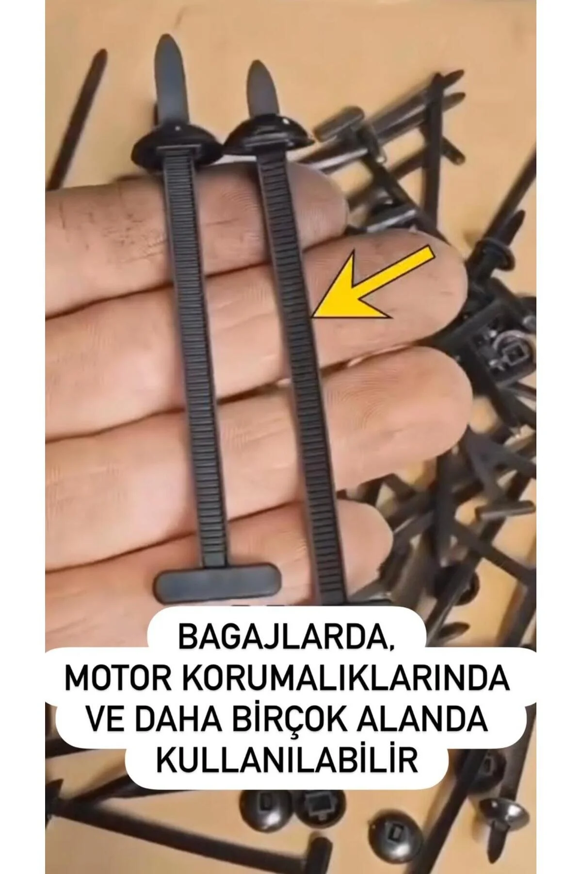 Yeni Nesil Plastik Cırt Kelepçe Klips 100lü Set 50 Büyük + 50 Küçük Otomobil Trim Kamp Tamir Sabitleme Seti Siyah