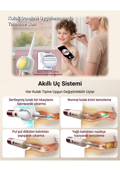 Bebird Ultra X 2k Hd Kameralı Akıllı Kulak Temizleme Ve Bakım Cihazı Hediye Kutulu