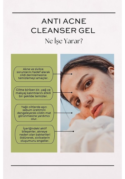 Peonies acne Cleanser Gel Yağlı Akneli Ve Karma Ciltler Için Salisilik Asitli Yıkama Jeli