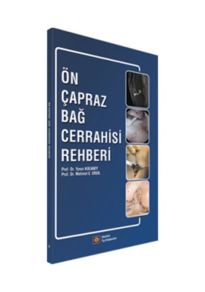 Ön Çapraz Bağ Cerrahisi Rehberi