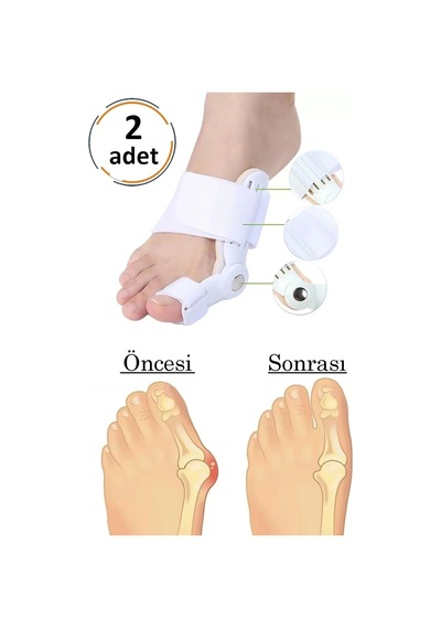 Ayak Parmak Başparmak Düzeltici Atel 2'li