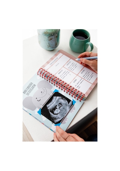 Bebek Anı Defteri Ve Hamile Albümü Kız + Sticker