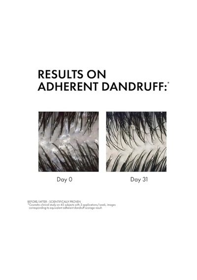 Dercos Anti Dandruff Kuru Saçlar İçin Kepek Karşıtı Şampuan 200 Ml Salisilik Asit Ve Selenyum Sülfür, Kaşıntıyı Yatıştırır, Besler, Dermatolojik