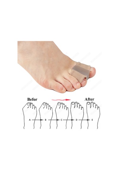 Ayak Parmağı Düzeltici Haluks Halluks Valgus Bunyon Makara