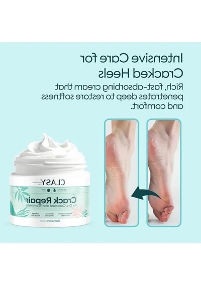 Yoğun Nemlendirici Ayak Kremi, E Vitamini Ve Avokado Yağı İle, 100 Ml
