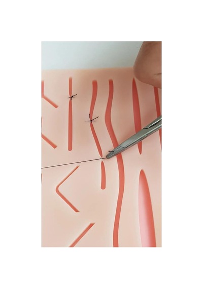 Doktor Sütür Dikiş Sütür Eğitim İğnesi 2 Adet 3/0 Sütür İğne Genel