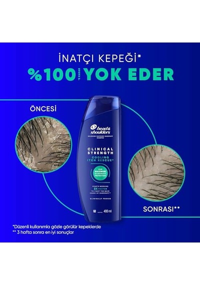 &amp Shoulders Clinical Strength Cooling Itch Rescue Kaşıntı Karşıtı Şampuan 400 Ml