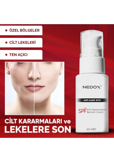 Nedox Cilt Beyazlatıcı Leke Kremi 60 ML