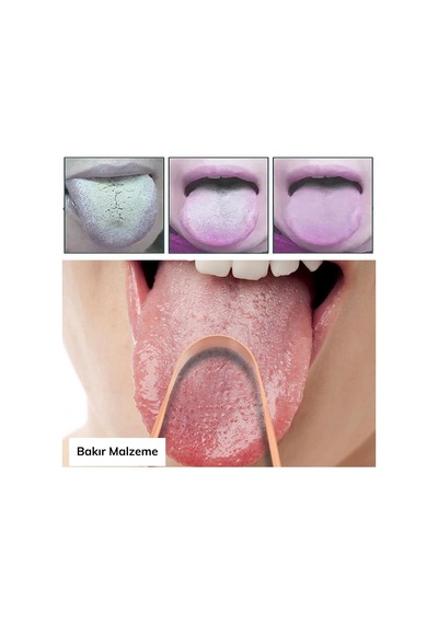 Kuhı Bakır Oil Pulling Yağ Çekme Dil Plak Temizleme Aleti Dil Fırçası Sıyırıcı Dil Kaşığı