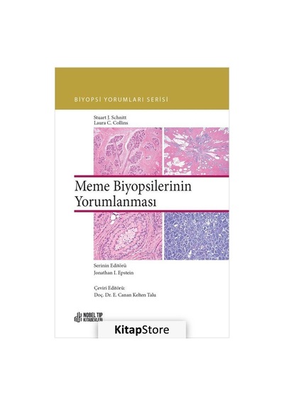 Meme Biyopsilerinin Yorumlanması - Laura C. Collins - Nobel Tıp Kitabevleri