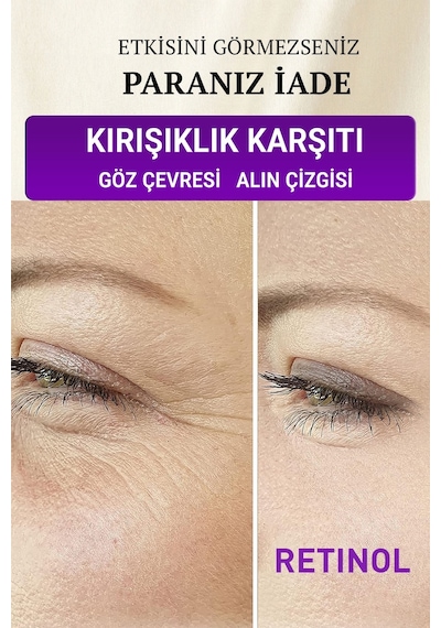 Devida Yaşlanma ve Kırışıklık Karşıtı Göz Çevresi Retinol Serum 30 ML