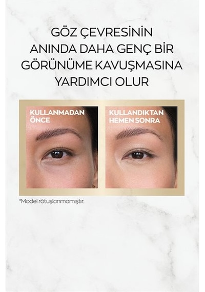 Avon Anew Renewal Power Göz Çevresi Kremi 15 ML