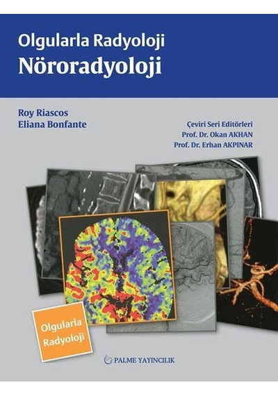 Olgularla Radyoloji Nöroradyoloji (Palme)