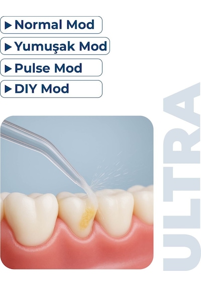 Aquadent Ultra Ağız Duşu - Şarjlı Taşınabilir, 4 Farklı Mod, Ipx7 Su Geçirmez