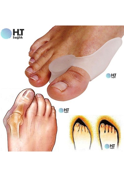 Ayak Başparmak Bunyon Koruyucu Makaralı Koruma Halluks Valgus
