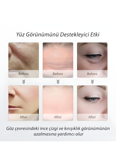 M2 Yüz Masaj Aleti Mikro Akım, Kırmızı Işık, Isı Ve Titreşim Destekli Ev Tipi Cilt Bakım Cihazı