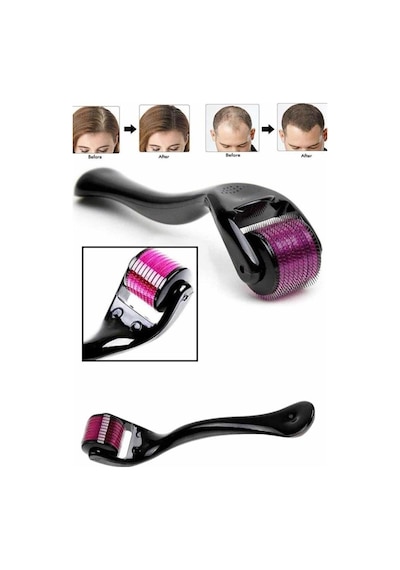 Gld-spt- Derma Roller Titanyum Uçlu 540 İğneli 1 Mm Saç Sakal Çıkarma Ve Cilt Bakım Masaj Aleti