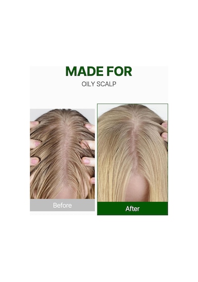 Sorunlu Saç Derisine Özel Şampuan Tea Tree & Macadamia Deep Cleansing Shampoo Baby Powder
