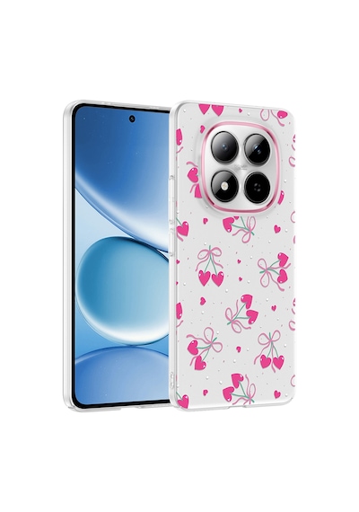 Teleplus Xiaomi Redmi Note 15 Pro 4g Kılıf Klipx Serisi Mat Desenli Tpu Kapak