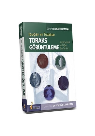 İpuçları Ve Tuzaklar Toraks Görüntüleme/Ayşegül Sarsılmaz