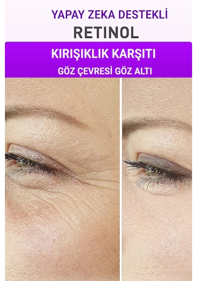 Retinol + Kolajen Serum 2 Li Set  Alın Çizgisi Göz Çevresi Ve Kaz Ayağı